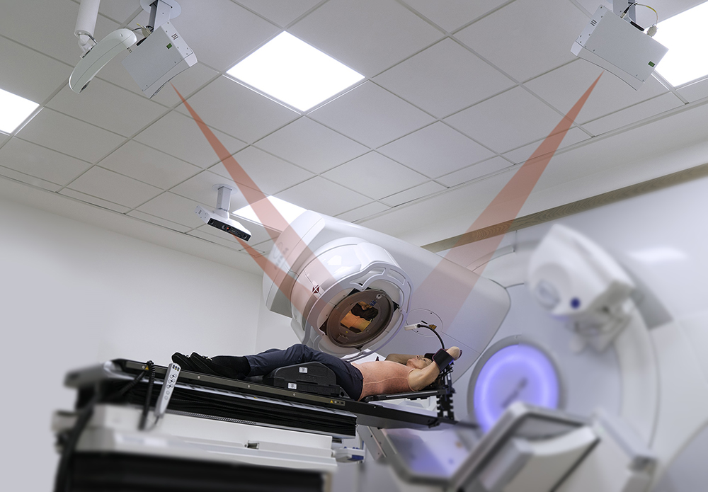 Align RT advance system