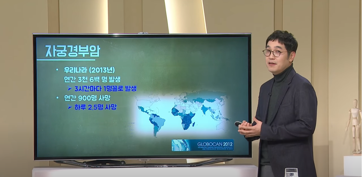 [대구MBC 약손] 회춘인가, 자궁암인가-산부인과 이대형 교수(2/2)
