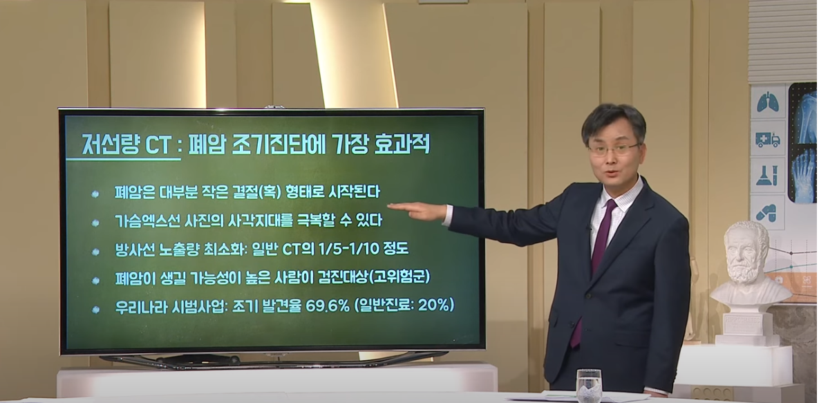 [대구MBC 약손] 폐암, 생존율을 높이는 방법-호흡기내과 신경철 교수(1/2)