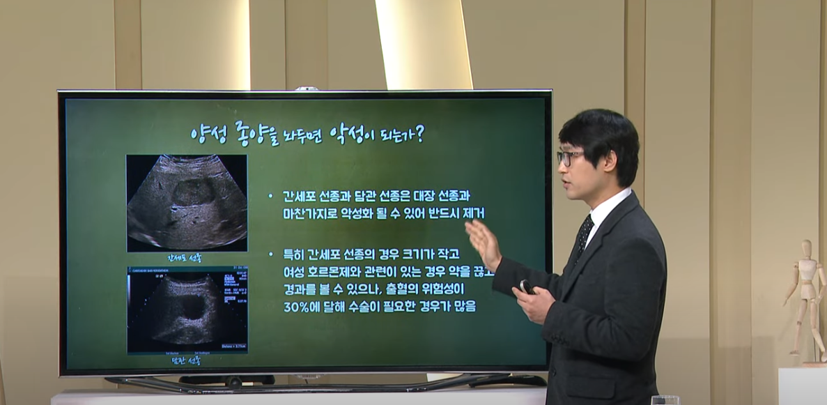 [대구MBC 약손] 침묵 속의 위험, 간암-소화기내과 박정길 교수(1/2)