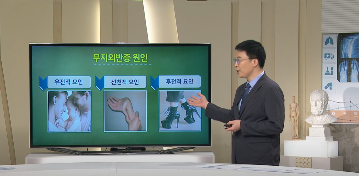 [대구MBC 약손] 족부질환-정형외과 박철현 교수