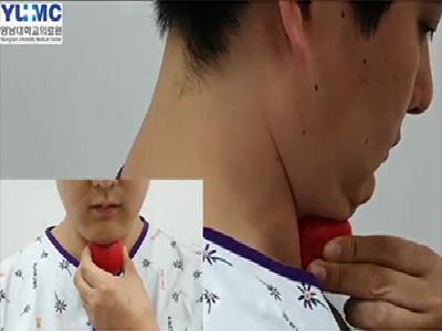 연하장애 환자를 위한 저항성고개숙이기운동