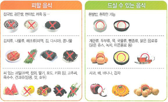 피할 음식과 드실 수 있는 음식 리스트(다음 내용 참조)