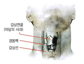 아담의 사과라고 불리는 갑상선 연골 아래에 위치